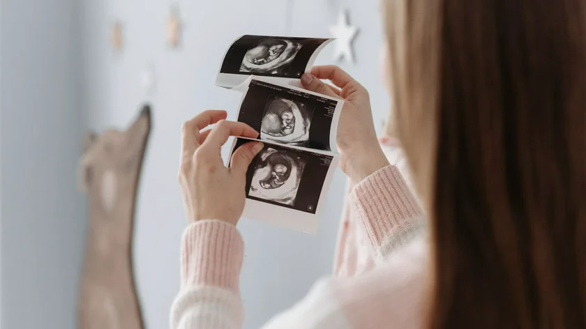 Clayo Clinic Nov2023 FB IVF pexels_pavel_danilyuk_7055905_thumb